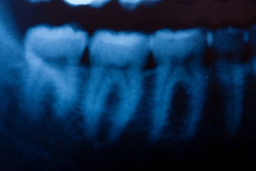 dental x-ray