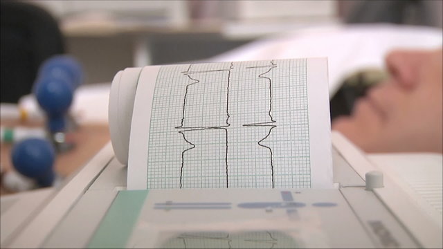 cardiogram