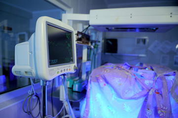 Cardiac monitor at incubator's room
