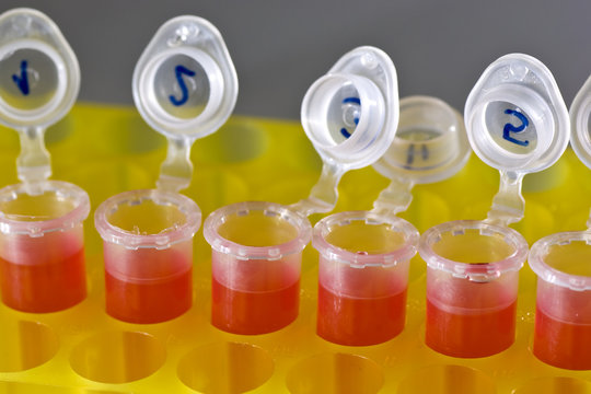 Investigaci&oacute;n en rojo