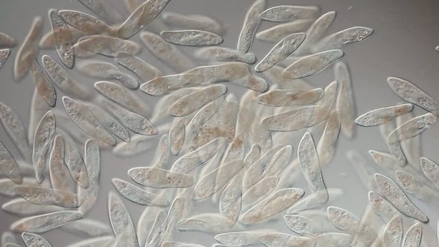 Paramecium caudatum Massenvorkommen