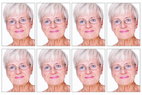 Biometric Images of an elderly lady