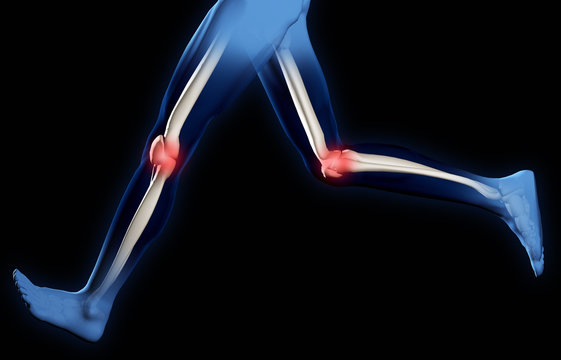 Pain in knee joints
