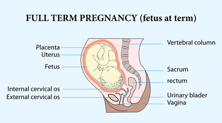 FUll term pregnanchy