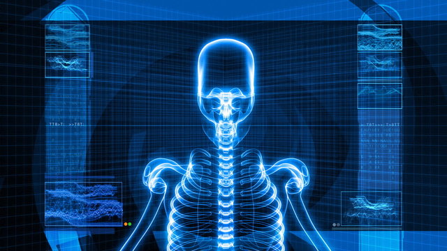 X-Ray of Human Head (HD)