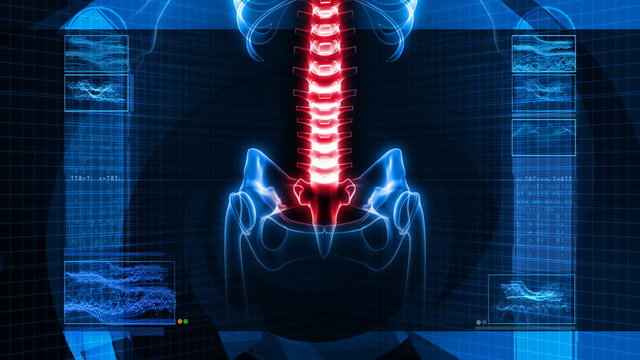 X-Ray of Human Skeleton - Spine (HD)