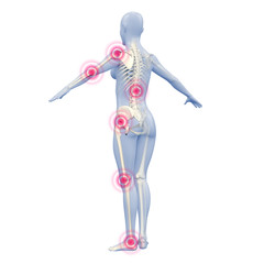 Silhouette junger Frau mit Gelenkschmerzen