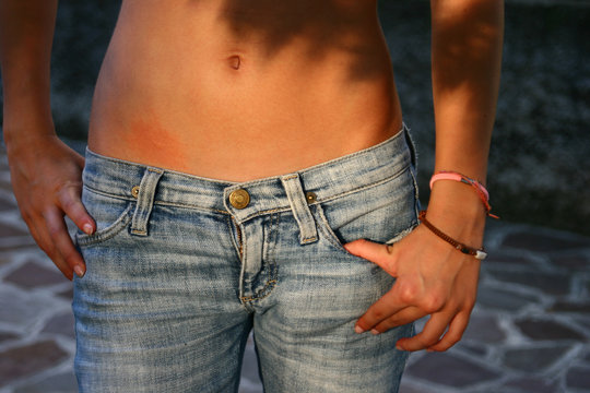 Ragazza con puntura di zanzara