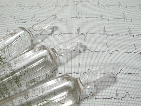 Ampullen und EKG-Papier