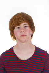 attractive boy in puberty with red hair