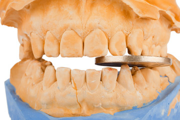 Münze zwischen den Zähnen eines Gebiss-Modells