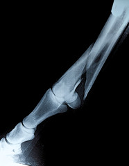 Fraktur Pferd Vorderlauf © A_n_d_i_K