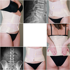 fascia lombare donna con radiografie - obrazy, fototapety, plakaty