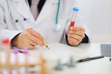 Closeup on hands of medical doctor holding blood sample