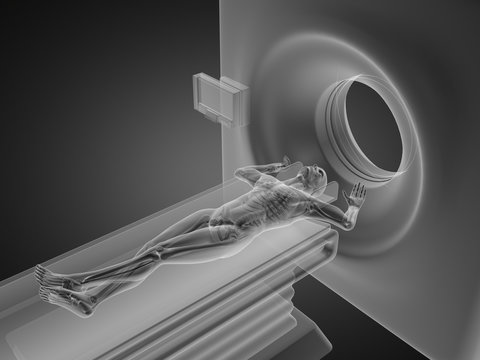MRI examination made in 3D