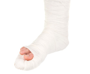 leg in a plaster cast