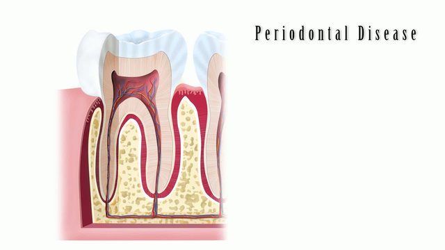 Dental Problems