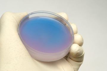 Keime im Labor gezüchtet