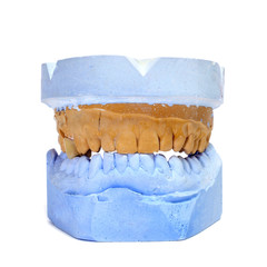 dental mould
