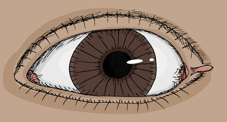 Eye With Skin Tag