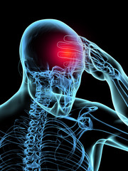 Migräne Anfall Cluster Kopfschmerzen - obrazy, fototapety, plakaty