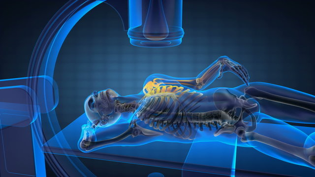 лада икс рей юролтюнинг. лада xray. лада xray 2014. лада икс рей зенкевич. Lada xray cross 2.