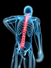 3d rendered medical x-ray illustration -  male backache