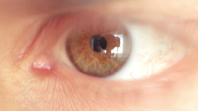 Eye close up