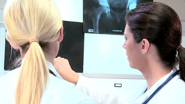 Female Doctors Inspecting X-Ray Results