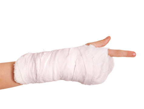 Broken arm in a cast