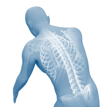 Rückenschmerzen - Rücken mit Röntgenbild