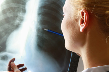 Female doctor with an x-ray