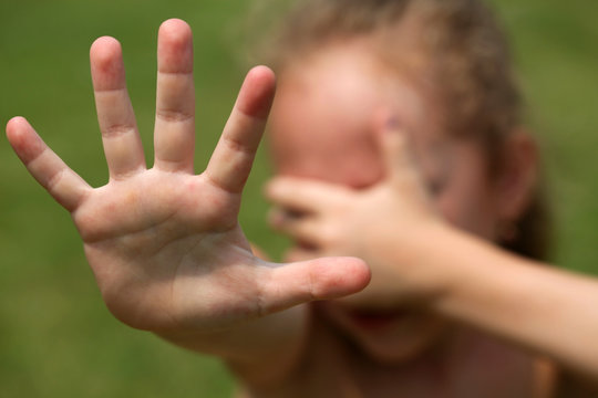 child refuses, and is covered hands