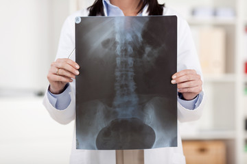 ärztin zeigt röntgenaufnahme