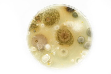 Macro mold and bacterai colonies growing on an agar plates.