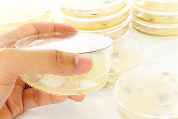 Macro mold and bacterai colonies growing on an agar plates.
