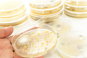 Macro mold and bacterai colonies growing on an agar plates.