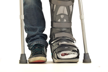 Gipsfu&szlig; 4.4.12