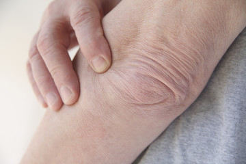 man with a sore elbow