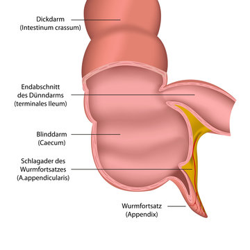 appendix medical vector illustration