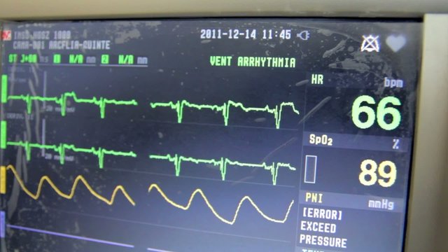 Electrocardio 5