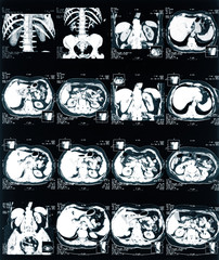 MRI.  X-ray of the pelvis and spinal column