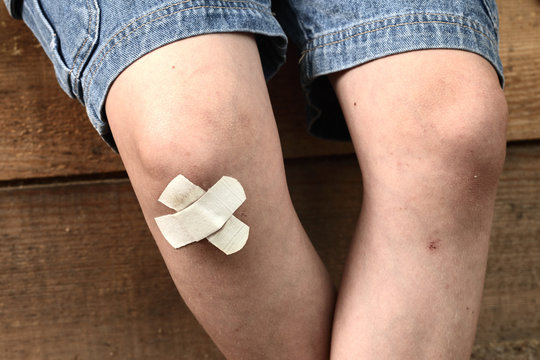 bruise on the boy's leg