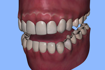 ARCATA DENTARIA 3D © McCarony