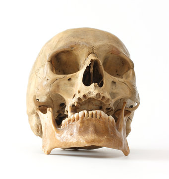 Human skull.