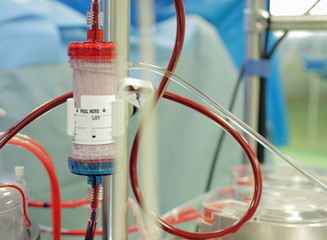 ultrafiltration during cardiopulmonary bypass.