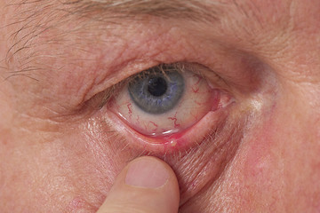 Soin de l'oeil  - Orgelet