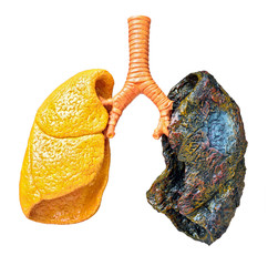 Smoking kills
