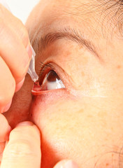 woman taking eyedrops