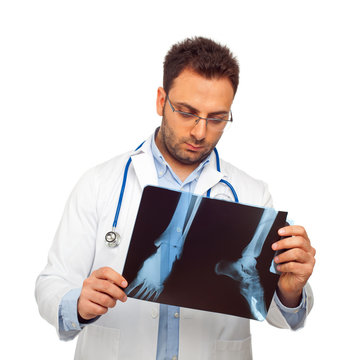 Radiografia caviglia